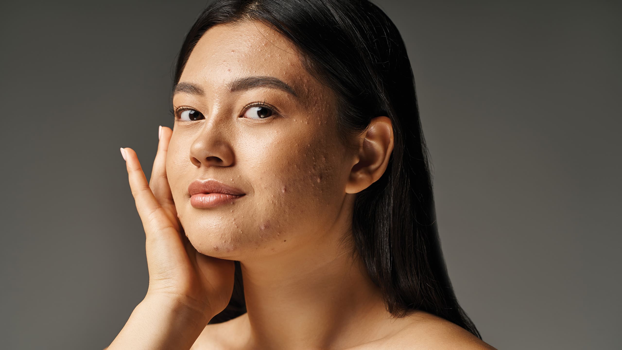 How to Get Rid of Cystic Acne Once and For All, According to Dermatologists