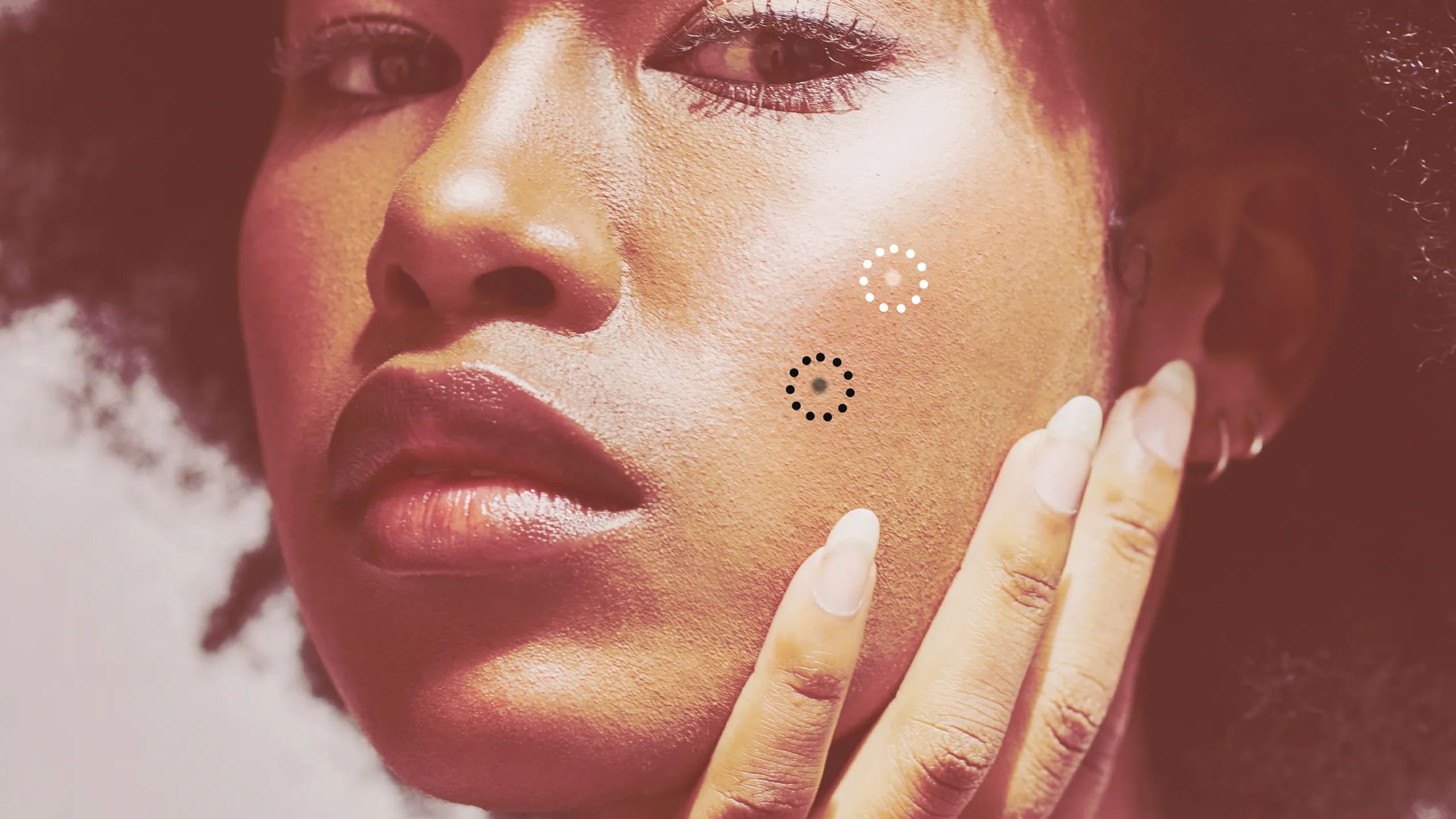 You’ve Probably Had Comedonal Acne — Here’s How to Make It Go Away