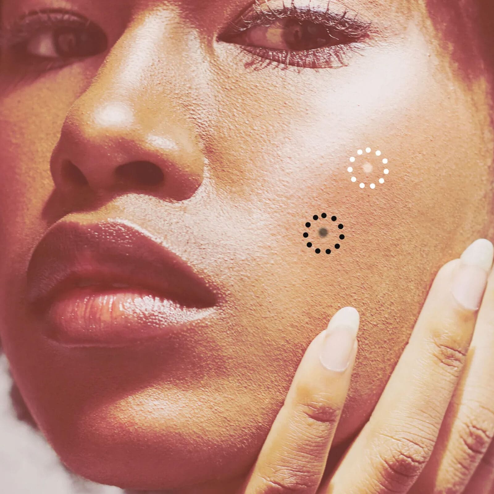 You’ve Probably Had Comedonal Acne — Here’s How to Make It Go Away
