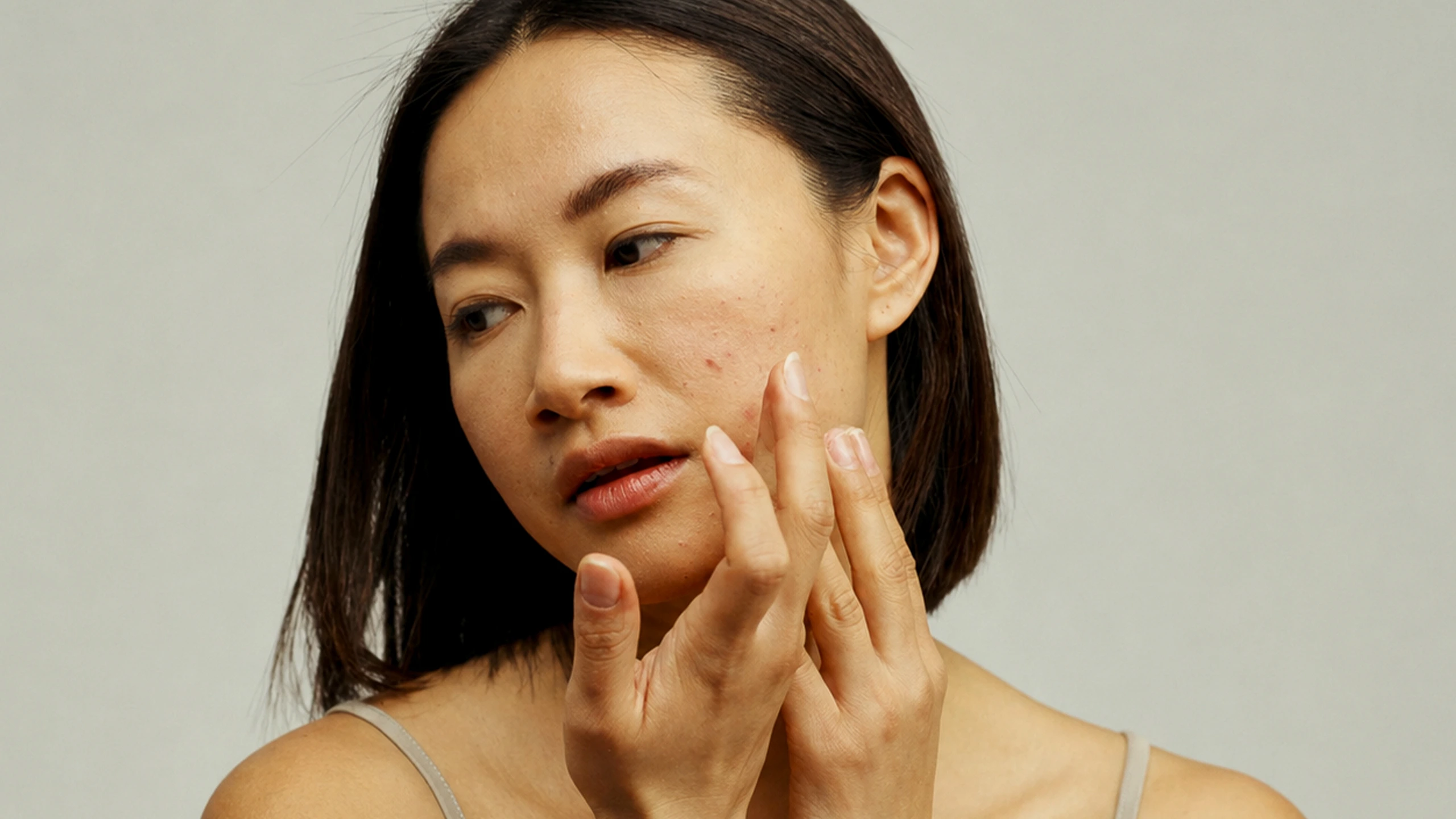 Allure Philippines Acne Treatments