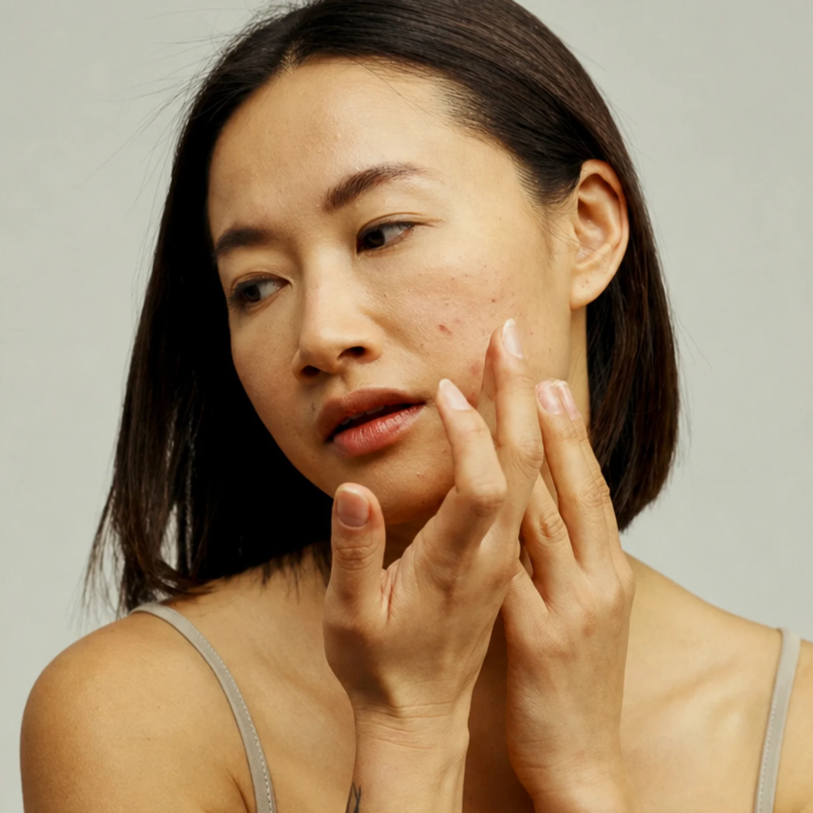 Allure Philippines Acne Treatments