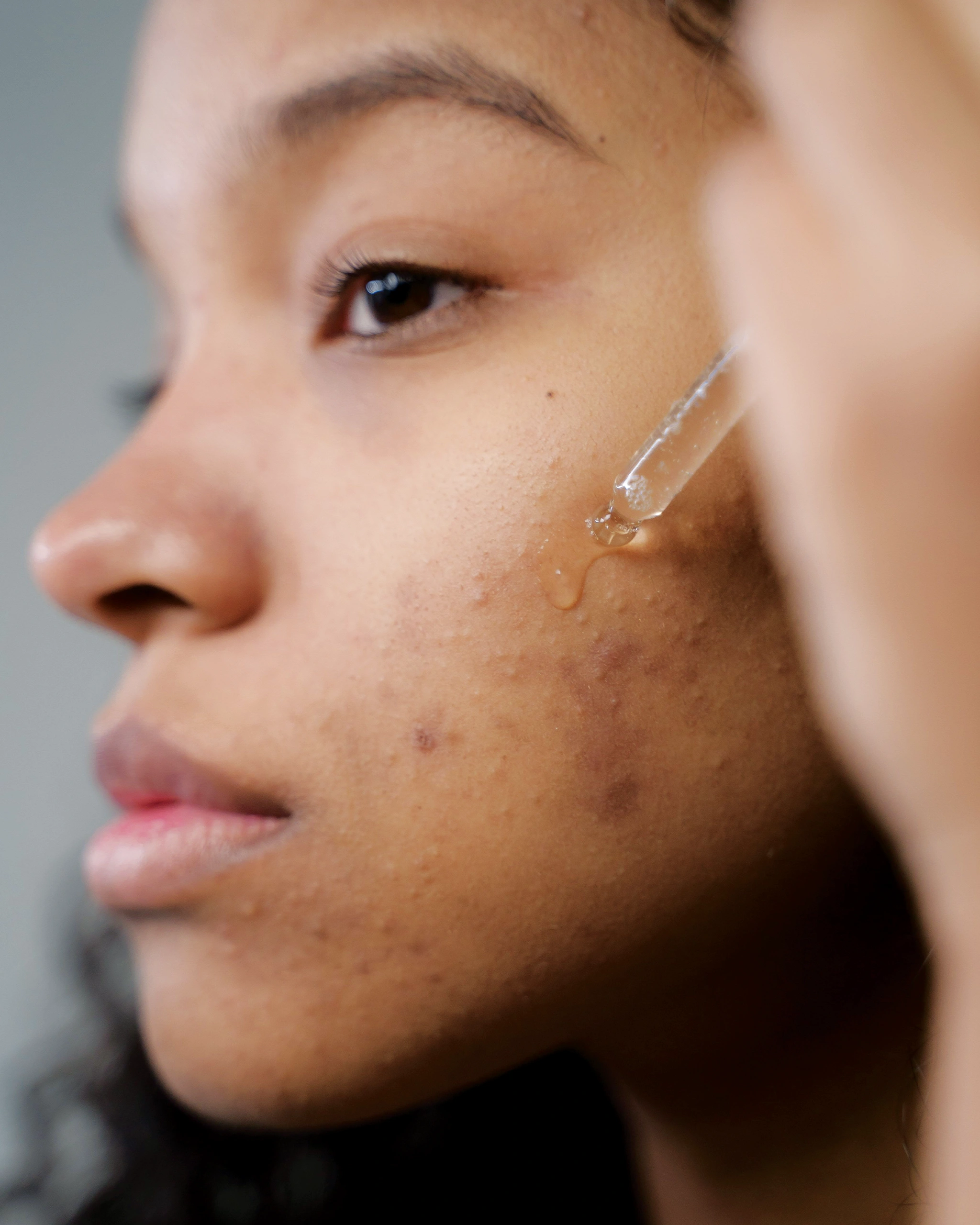Close-up of a person's profile with a bead of clear liquid running down the cheek near the eye.