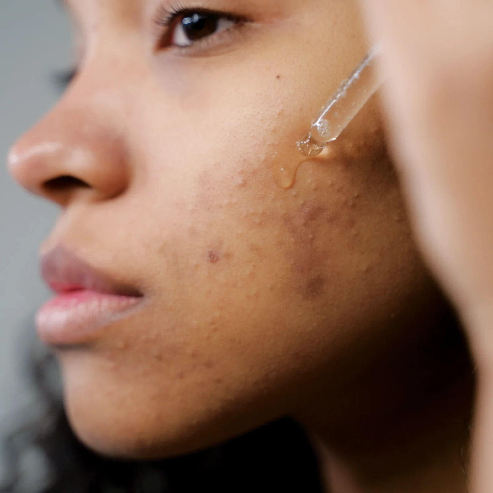 Close-up of a person's cheek with a tear sliding down the face under the eye.